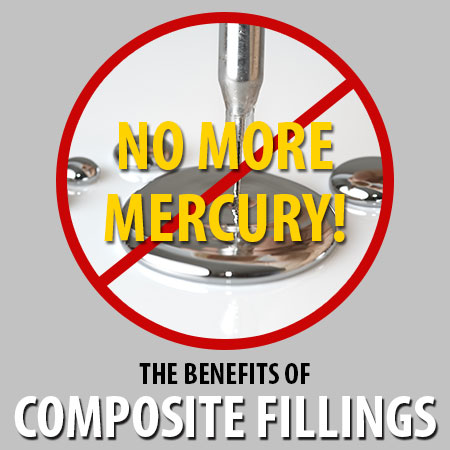 Composite Fillings, No More Mercury, Hillcrest dentist in San Diego