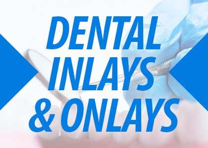 Healthy Teeth with Inlays and Outlays