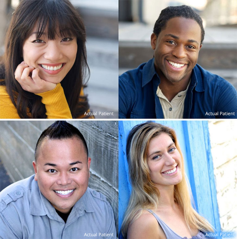 Make Over Smiles, Actual Patients of Complete Dental Health, your Hillcrest Dentist in San Diego, CA